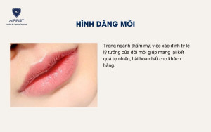 Hình dáng môi